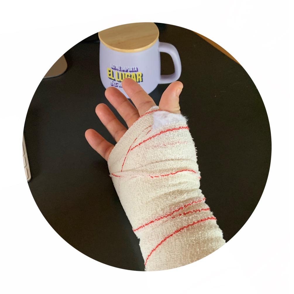 OpErAcIóN TúNel CaRpIaNo ( Usuario silla de&nbsp;Ruedas)